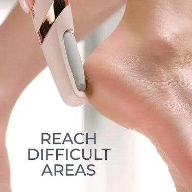 Electric Callus Remover - Rechargeable Foot Care Tool for Dry Skin & Cracked Heels
