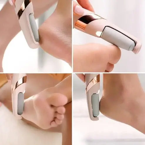 Electric Callus Remover - Rechargeable Foot Care Tool for Dry Skin & Cracked Heels