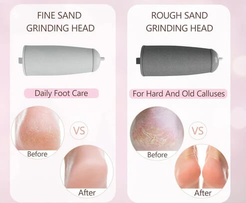 Electric Callus Remover - Rechargeable Foot Care Tool for Dry Skin & Cracked Heels